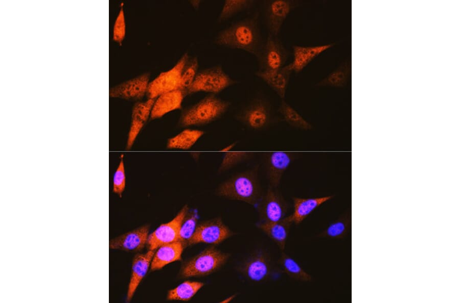Immunofluorescence - Anti-JAB1 Antibody [ARC0895] (A306818) - Antibodies.com