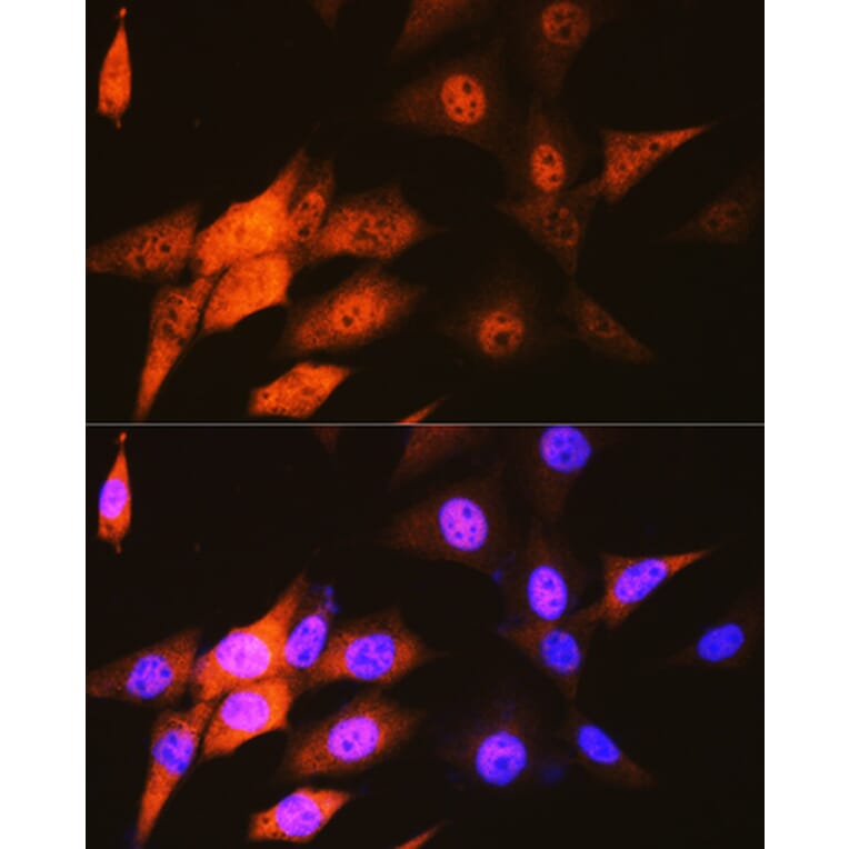 Immunofluorescence - Anti-JAB1 Antibody [ARC0895] (A306818) - Antibodies.com
