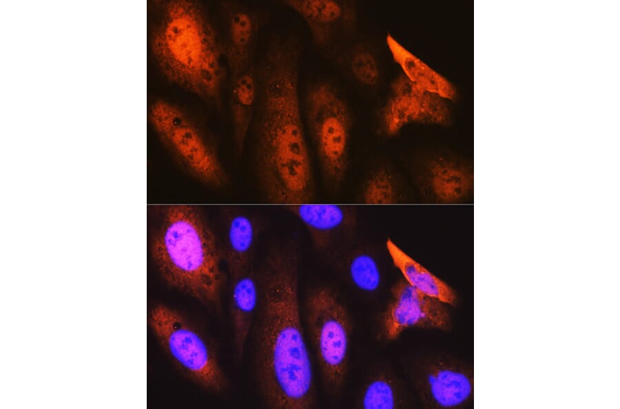 Immunofluorescence - Anti-JAB1 Antibody [ARC0895] (A306818) - Antibodies.com