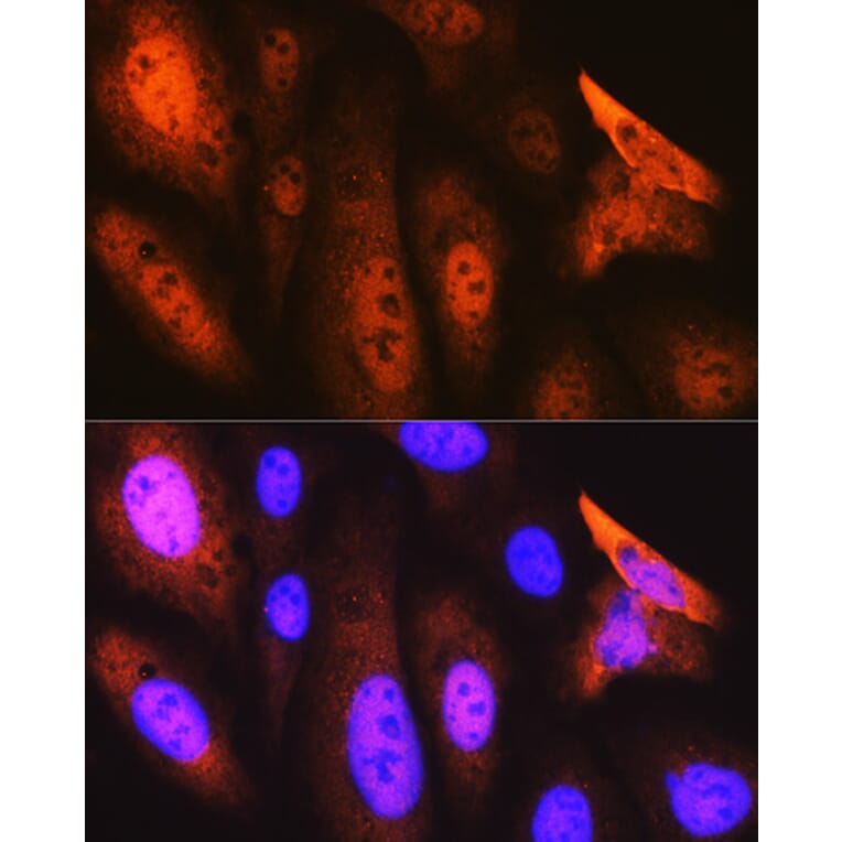 Immunofluorescence - Anti-JAB1 Antibody [ARC0895] (A306818) - Antibodies.com