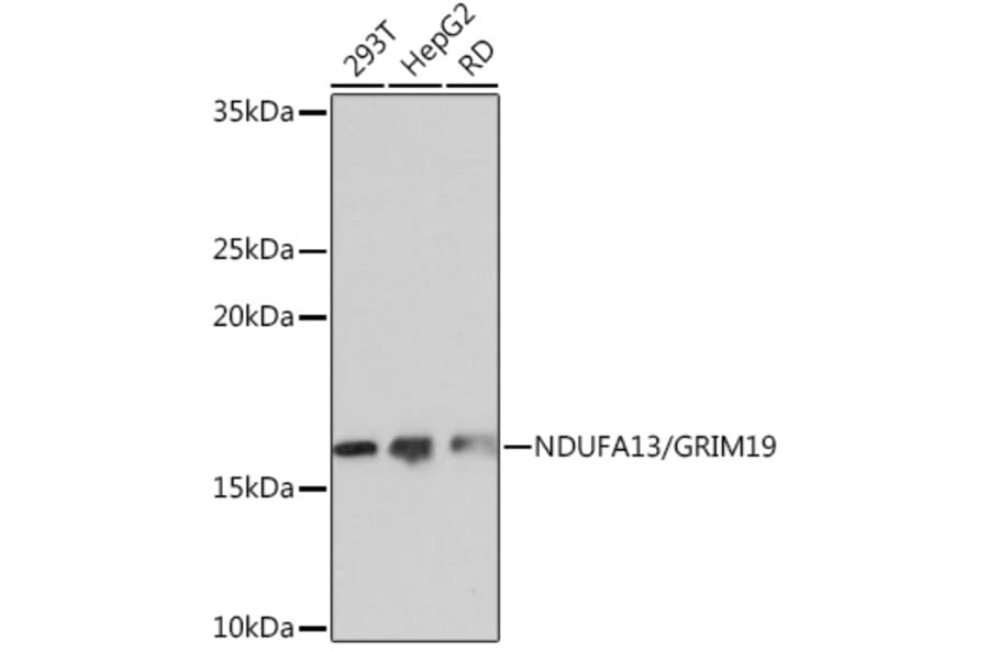 Western Blot - Anti-GRIM19 Antibody [ARC0833] (A306819) - Antibodies.com