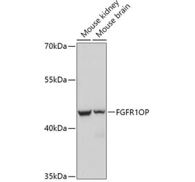 Western Blot - Anti-FGFR1 Oncogene Partner Antibody (A306820) - Antibodies.com