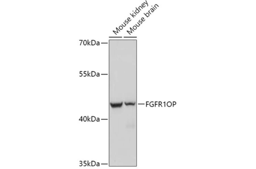 Western Blot - Anti-FGFR1 Oncogene Partner Antibody (A306820) - Antibodies.com