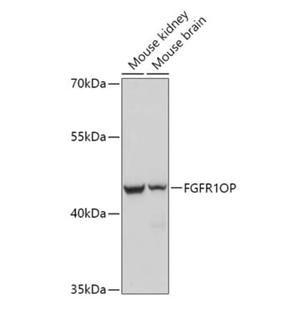 Western Blot - Anti-FGFR1 Oncogene Partner Antibody (A306820) - Antibodies.com