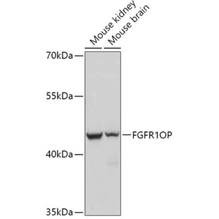 Western Blot - Anti-FGFR1 Oncogene Partner Antibody (A306820) - Antibodies.com