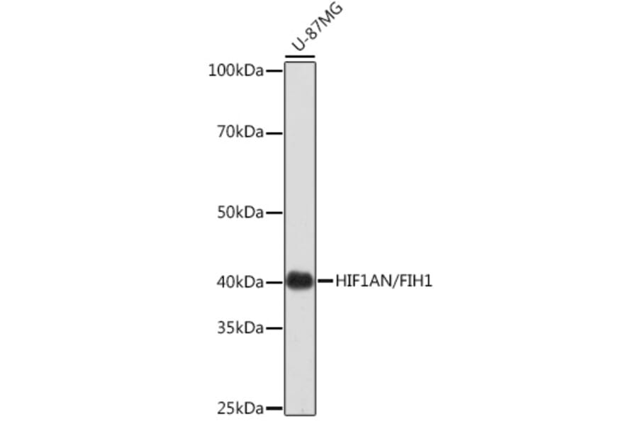 Western Blot - Anti-HIF1AN/FIH-1 Antibody [ARC0826] (A306821) - Antibodies.com
