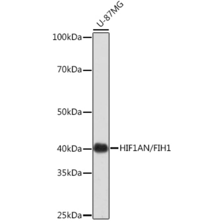 Western Blot - Anti-HIF1AN/FIH-1 Antibody [ARC0826] (A306821) - Antibodies.com