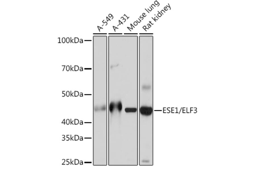 Western Blot - Anti-ESE1 Antibody [ARC1191] (A306822) - Antibodies.com