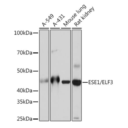 Western Blot - Anti-ESE1 Antibody [ARC1191] (A306822) - Antibodies.com