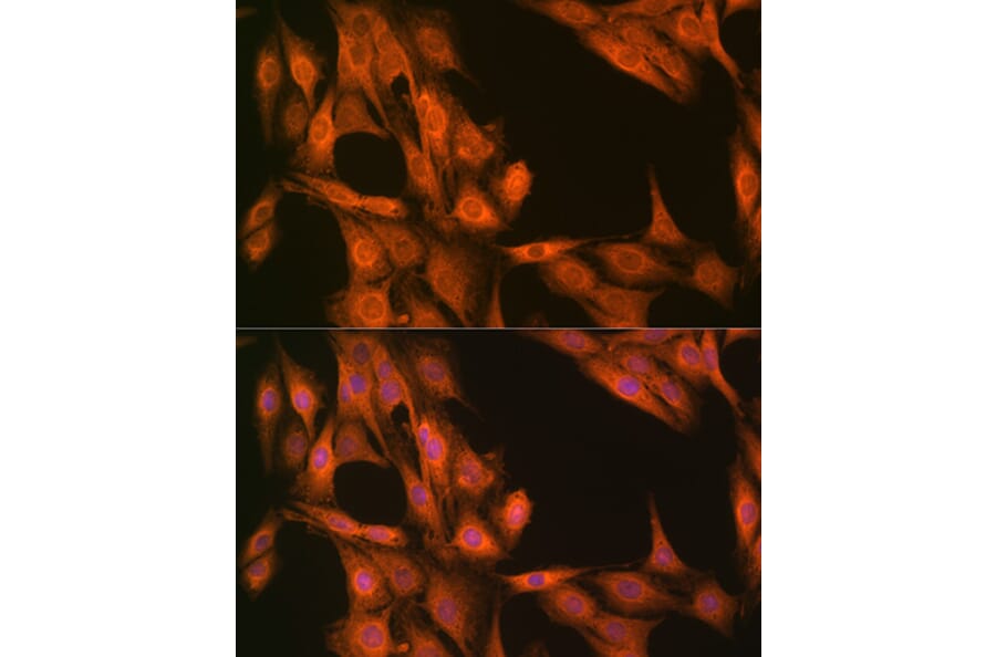 Chromatin Immunoprecipitation - Anti-ESE1 Antibody (A306822) - Antibodies.com