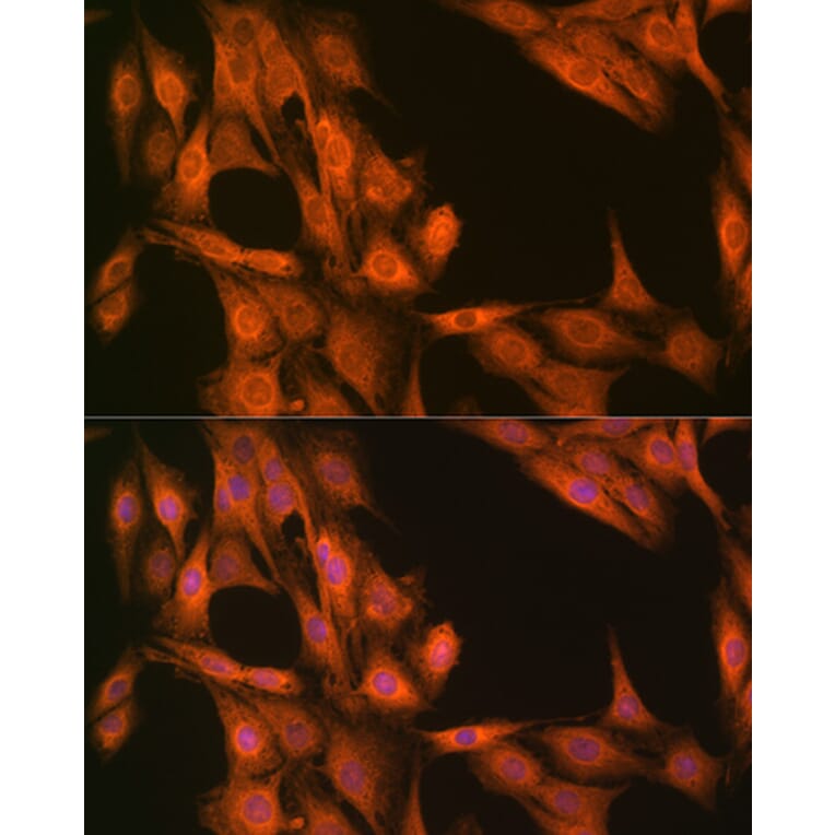 Chromatin Immunoprecipitation - Anti-ESE1 Antibody (A306822) - Antibodies.com