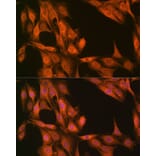 Chromatin Immunoprecipitation - Anti-ESE1 Antibody (A306822) - Antibodies.com