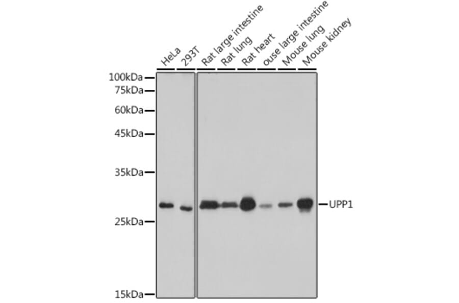 Western Blot - Anti-Uridine Phosphorylase 1 Antibody [ARC2531] (A306823) - Antibodies.com
