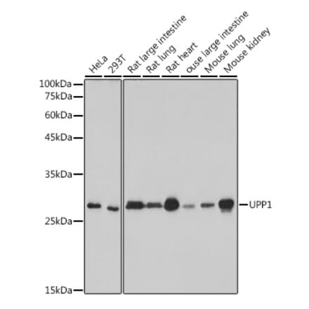 Western Blot - Anti-Uridine Phosphorylase 1 Antibody [ARC2531] (A306823) - Antibodies.com