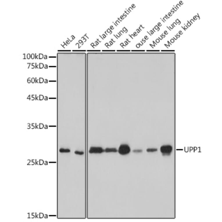 Western Blot - Anti-Uridine Phosphorylase 1 Antibody [ARC2531] (A306823) - Antibodies.com