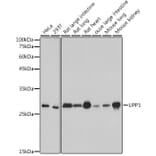Western Blot - Anti-Uridine Phosphorylase 1 Antibody [ARC2531] (A306823) - Antibodies.com