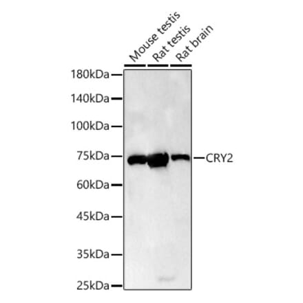 Western Blot - Anti-CRY2 Antibody (A306824) - Antibodies.com