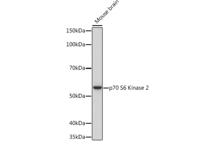 Western Blot - Anti-P70 S6 Kinase beta/SRK Antibody [ARC1790] (A306825) - Antibodies.com