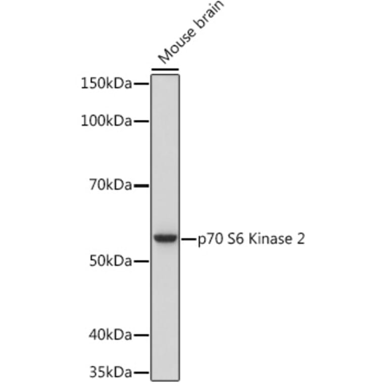 Western Blot - Anti-P70 S6 Kinase beta/SRK Antibody [ARC1790] (A306825) - Antibodies.com
