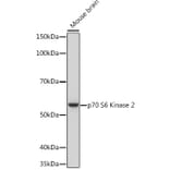 Western Blot - Anti-P70 S6 Kinase beta/SRK Antibody [ARC1790] (A306825) - Antibodies.com