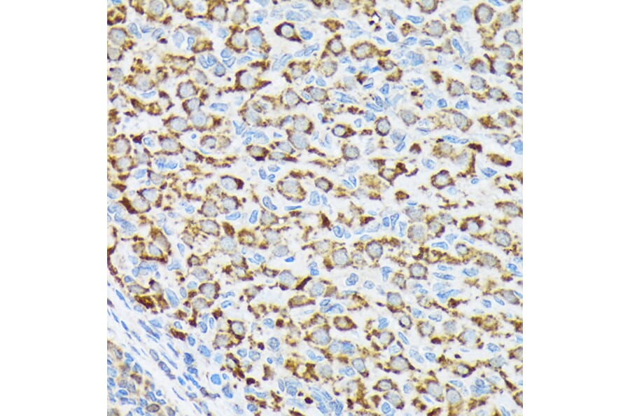 Immunohistochemistry - Anti-P70 S6 Kinase beta/SRK Antibody [ARC1790] (A306825) - Antibodies.com
