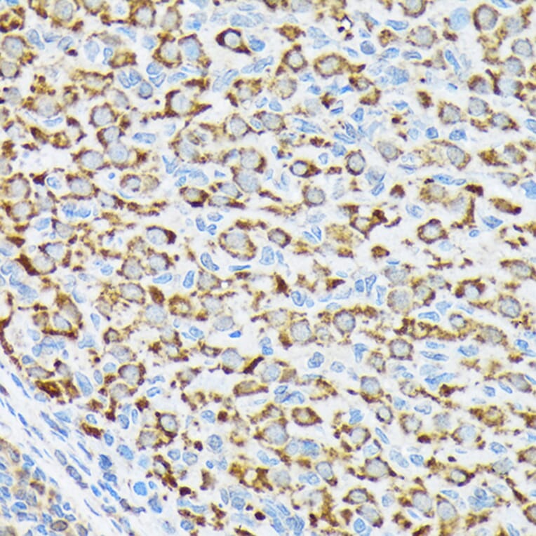 Immunohistochemistry - Anti-P70 S6 Kinase beta/SRK Antibody [ARC1790] (A306825) - Antibodies.com