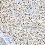Immunohistochemistry - Anti-P70 S6 Kinase beta/SRK Antibody [ARC1790] (A306825) - Antibodies.com