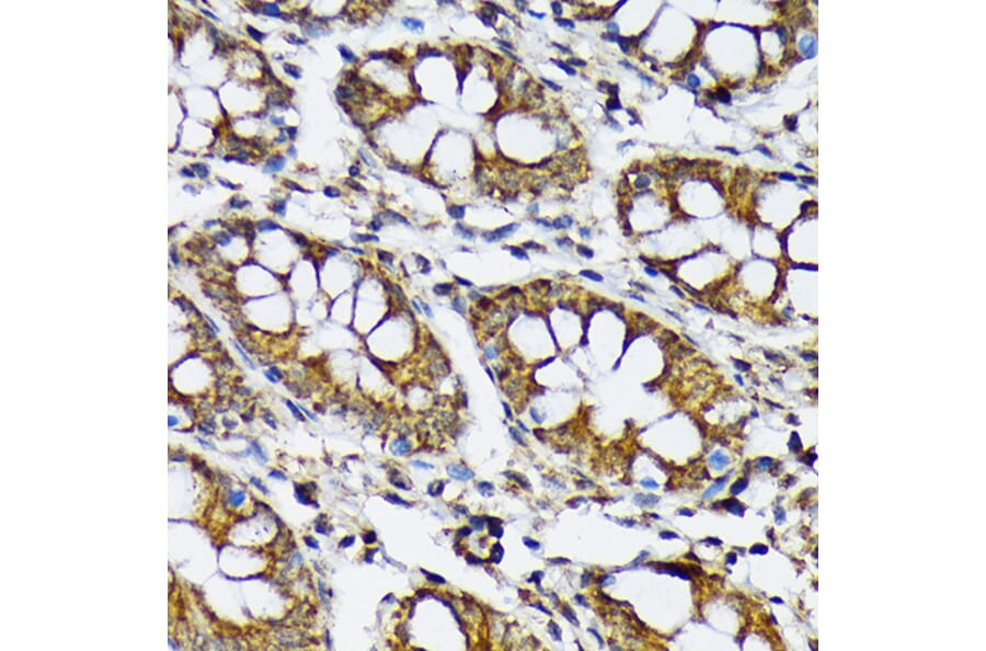 Immunohistochemistry - Anti-P70 S6 Kinase beta/SRK Antibody [ARC1790] (A306825) - Antibodies.com