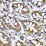 Immunohistochemistry - Anti-P70 S6 Kinase beta/SRK Antibody [ARC1790] (A306825) - Antibodies.com