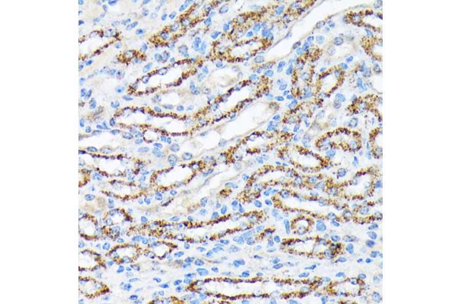 Immunohistochemistry - Anti-P70 S6 Kinase beta/SRK Antibody [ARC1790] (A306825) - Antibodies.com