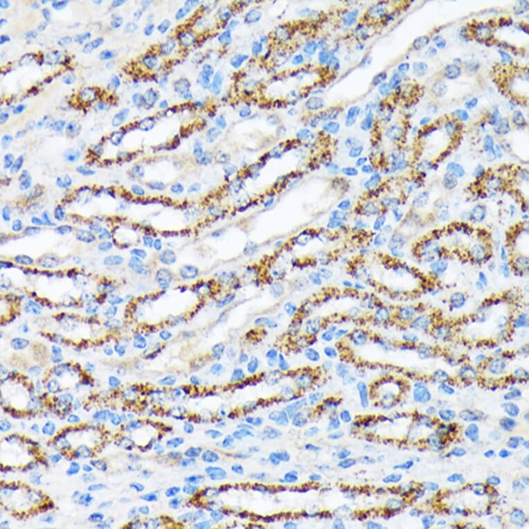 Immunohistochemistry - Anti-P70 S6 Kinase beta/SRK Antibody [ARC1790] (A306825) - Antibodies.com