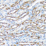 Immunohistochemistry - Anti-P70 S6 Kinase beta/SRK Antibody [ARC1790] (A306825) - Antibodies.com