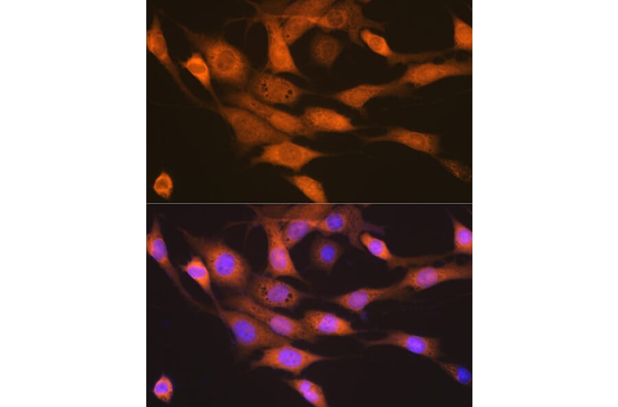 Immunofluorescence - Anti-P70 S6 Kinase beta/SRK Antibody [ARC1790] (A306825) - Antibodies.com