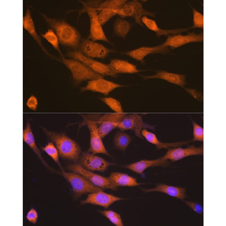 Immunofluorescence - Anti-P70 S6 Kinase beta/SRK Antibody [ARC1790] (A306825) - Antibodies.com