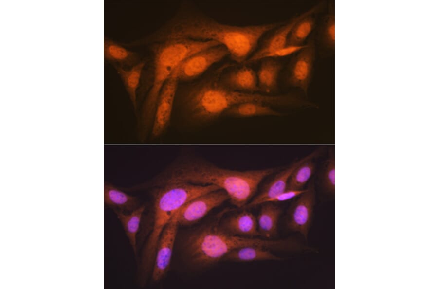 Immunofluorescence - Anti-P70 S6 Kinase beta/SRK Antibody [ARC1790] (A306825) - Antibodies.com
