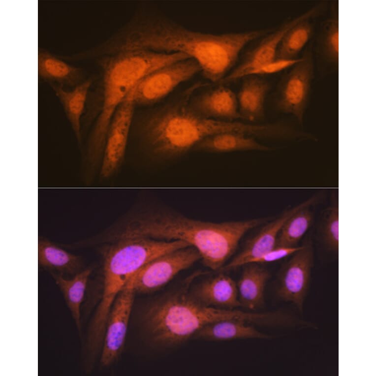 Immunofluorescence - Anti-P70 S6 Kinase beta/SRK Antibody [ARC1790] (A306825) - Antibodies.com