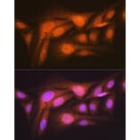 Immunofluorescence - Anti-P70 S6 Kinase beta/SRK Antibody [ARC1790] (A306825) - Antibodies.com