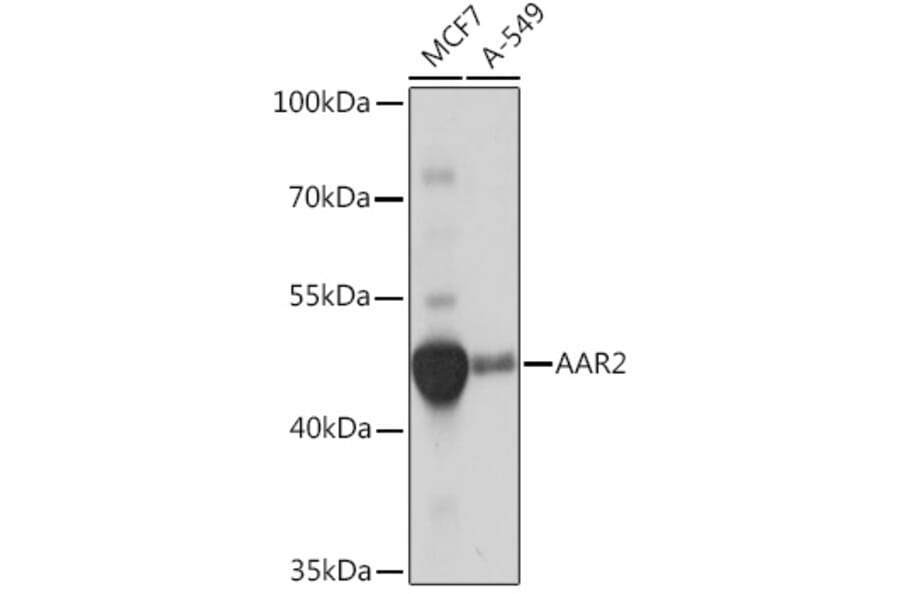 Western Blot - Anti-AAR2 Antibody (A306827) - Antibodies.com