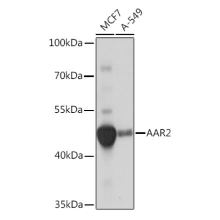 Western Blot - Anti-AAR2 Antibody (A306827) - Antibodies.com