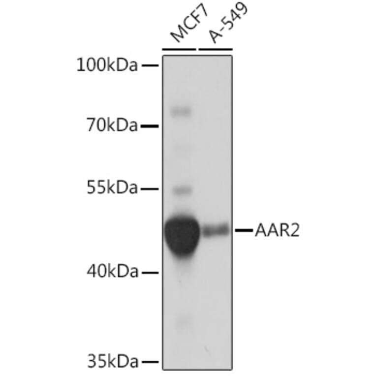 Western Blot - Anti-AAR2 Antibody (A306827) - Antibodies.com