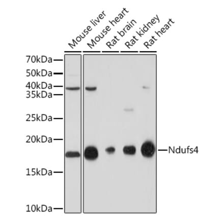 Western Blot - Anti-Ndufs4 Antibody [ARC1784] (A306828) - Antibodies.com