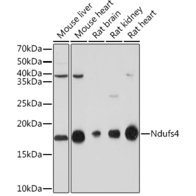 Western Blot - Anti-Ndufs4 Antibody [ARC1784] (A306828) - Antibodies.com