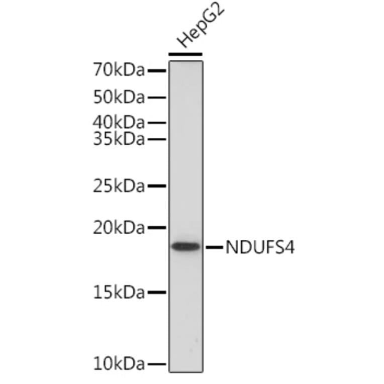 Western Blot - Anti-Ndufs4 Antibody [ARC1784] (A306828) - Antibodies.com