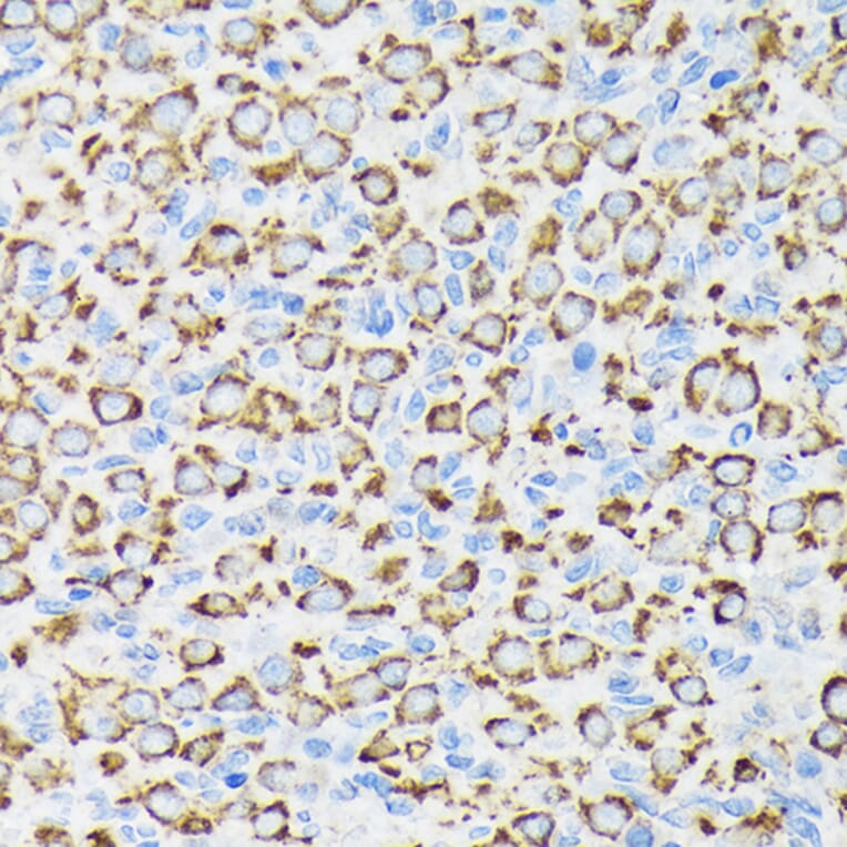 Immunohistochemistry - Anti-Ndufs4 Antibody [ARC1784] (A306828) - Antibodies.com