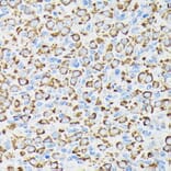 Immunohistochemistry - Anti-Ndufs4 Antibody [ARC1784] (A306828) - Antibodies.com