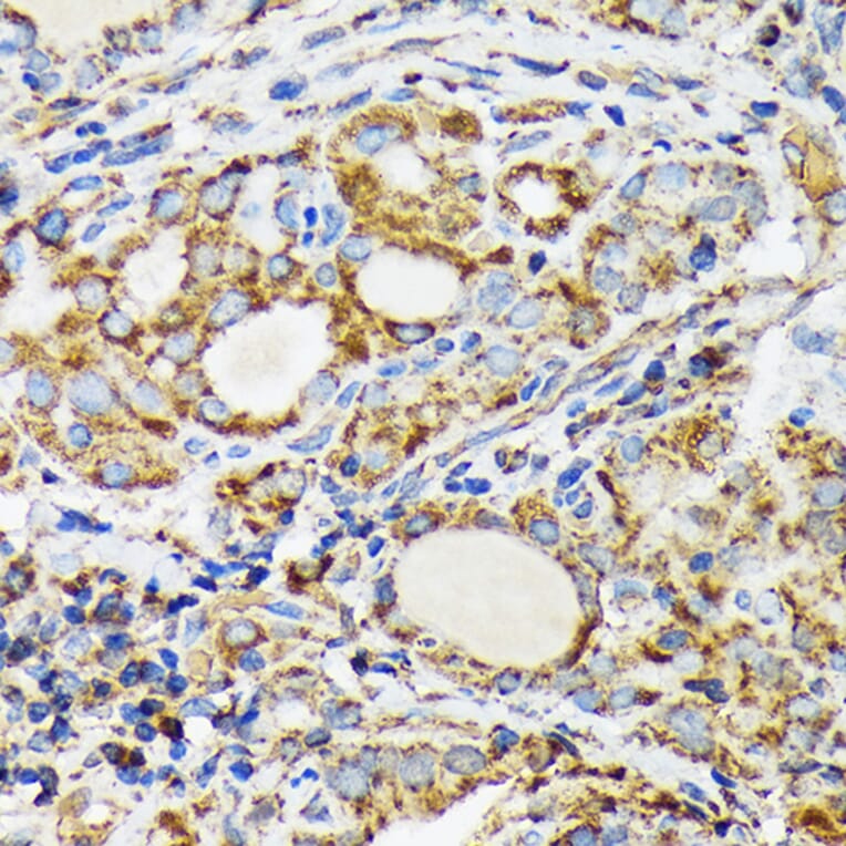 Immunohistochemistry - Anti-Ndufs4 Antibody [ARC1784] (A306828) - Antibodies.com