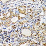 Immunohistochemistry - Anti-Ndufs4 Antibody [ARC1784] (A306828) - Antibodies.com