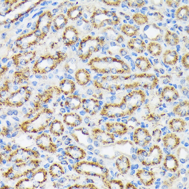 Immunohistochemistry - Anti-Ndufs4 Antibody [ARC1784] (A306828) - Antibodies.com