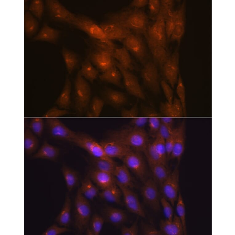 Immunofluorescence - Anti-Ndufs4 Antibody [ARC1784] (A306828) - Antibodies.com