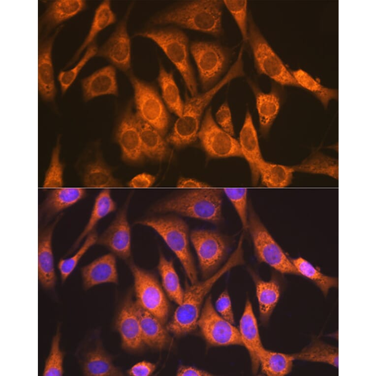 Immunofluorescence - Anti-Ndufs4 Antibody [ARC1784] (A306828) - Antibodies.com